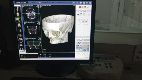 Tomógrafo Neusoft /philips 1