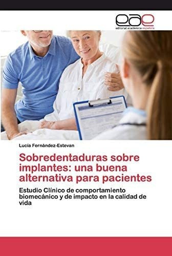Libro: Sobredentaduras Sobre Implantes: Una Buena Alternativ 0