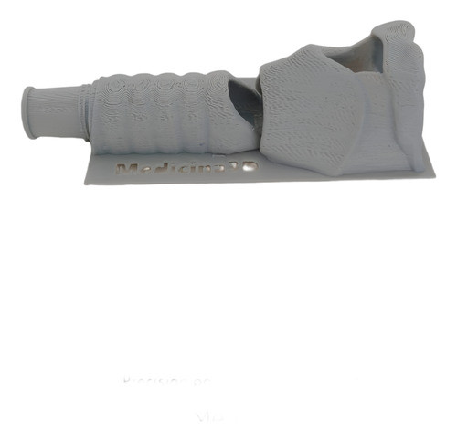 Modelo De Laringe Anatómica Impresa En 3d 0