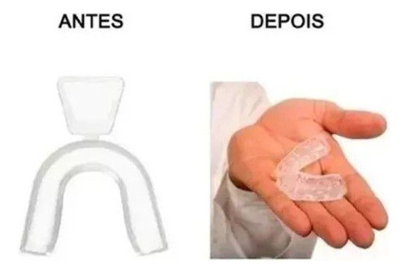 Moldeira Individual Bruxismo 1