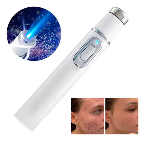 Láser Uv Terapia Led Elimina Cicatrices Manchas Acné 0 Láser Uv Terapia Led Elimina Cicatrices Manchas Acné 0