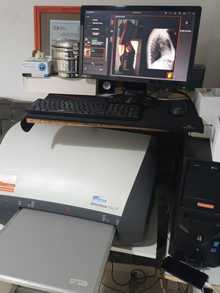 Equipo Digitalizador Carestream 0