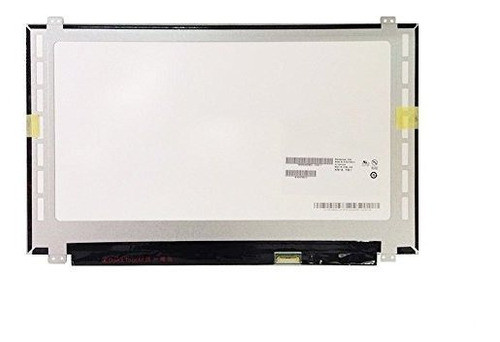 Dell Inspiron 15 5000 I5577  7700blkpus Series De Juegos156 0