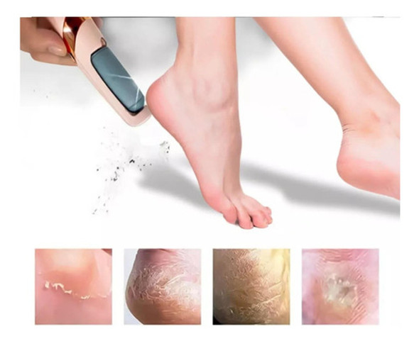 Removedor De Callos Inalámbrico - Torno Profesional Pies 1 Removedor De Callos Inalámbrico - Torno Profesional Pies 1