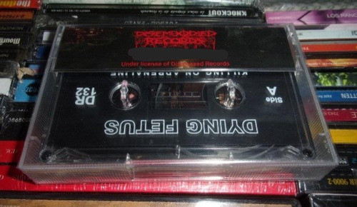 Cassette Dying Fetus Killing Of Adrenaline Nuevo Death L55 1