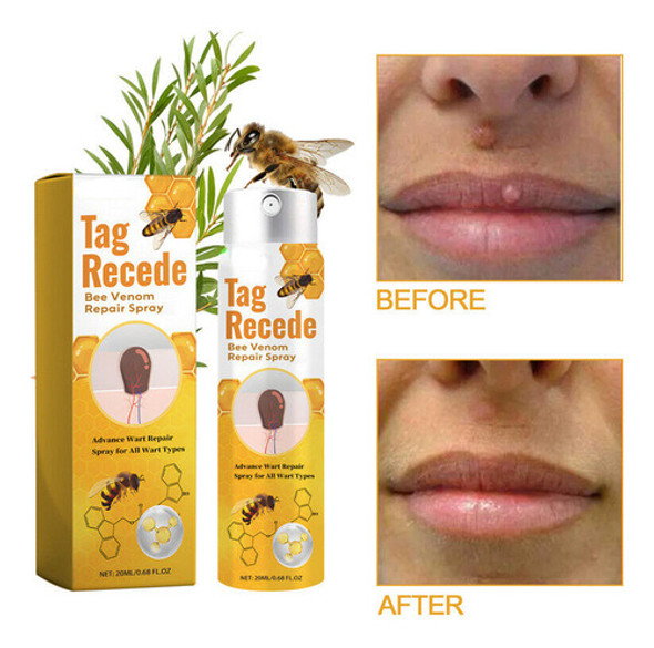 Creme Removedor De Verrugas Genitais De 20 Ml 0