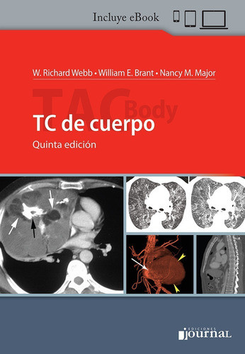Webb Brant Tac Body - Tc De Cuerpo 5ed/2020 Nuevo C/envío 0