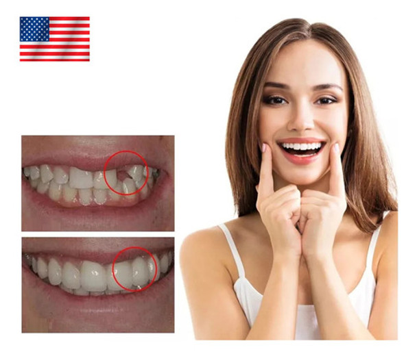 Reparacion Para Diente Relleno Provisorio Postizo Dental 0
