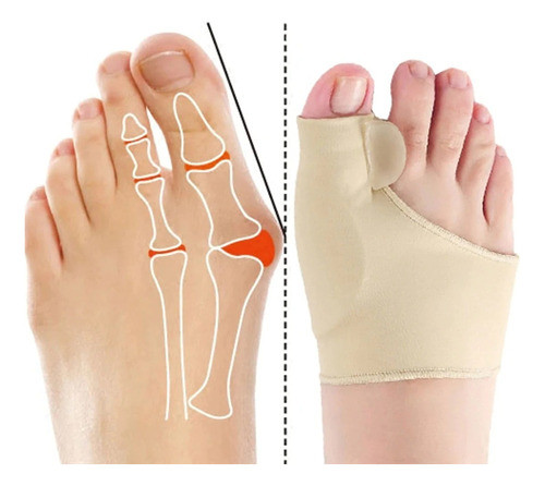 Correctores De Juanetes Gel Support Ortopédicos (2 Unidades) 0