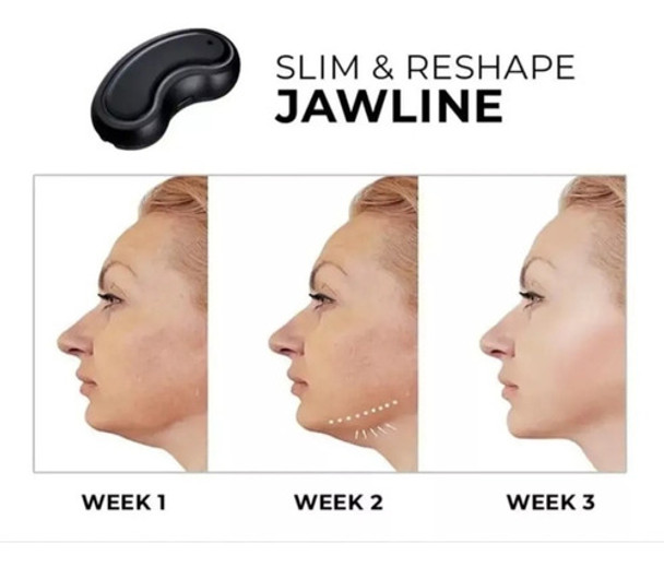 Soporte Anti Ronquido Tapón Inteligente Paradejar De Roncar 1 Soporte Anti Ronquido Tapón Inteligente Paradejar De Roncar 1