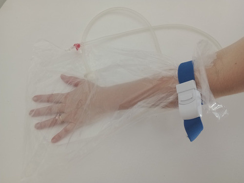 Luva Bag + Conector E Mangueira Para Ozonioterapia 0
