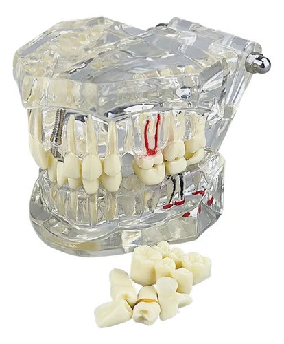 Modelo Dental Didáctico De Estudio  Y  Demostracion 0