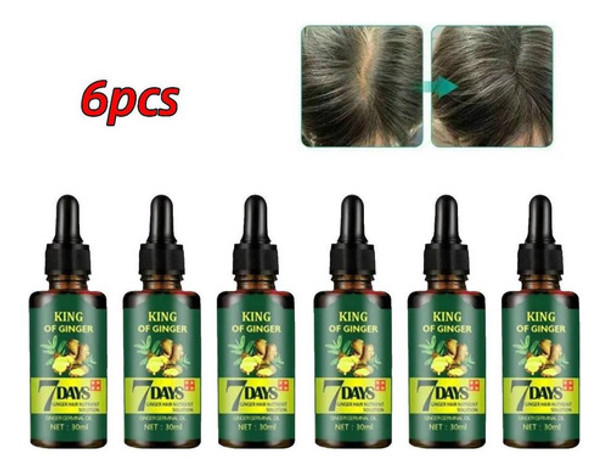 6 Unidades De Óleo De Cabelo Ginger King Nutre Os Folículos 0 6 Unidades De Óleo De Cabelo Ginger King Nutre Os Folículos 0
