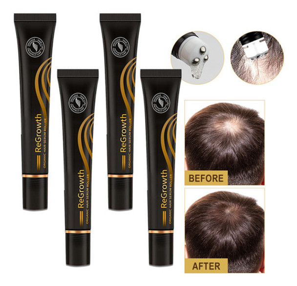 Dd Sérum Biotina Para Crescimento Capilar 4pcs 0 Dd Sérum Biotina Para Crescimento Capilar 4pcs 0