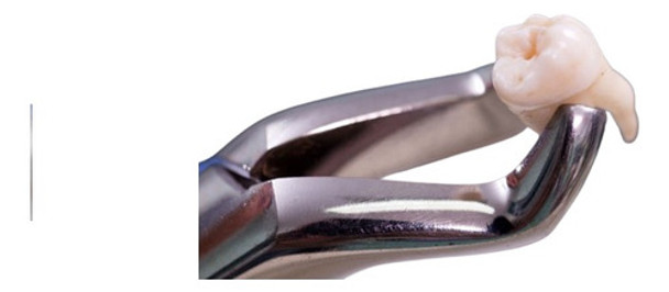 Extraccion Dentaria Compleja Consultorio Odontologico 0