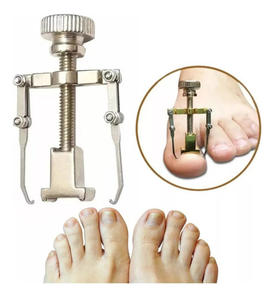 Desobstruidor Unha Encravada Aparelho Unha Eficiente Caseiro 0