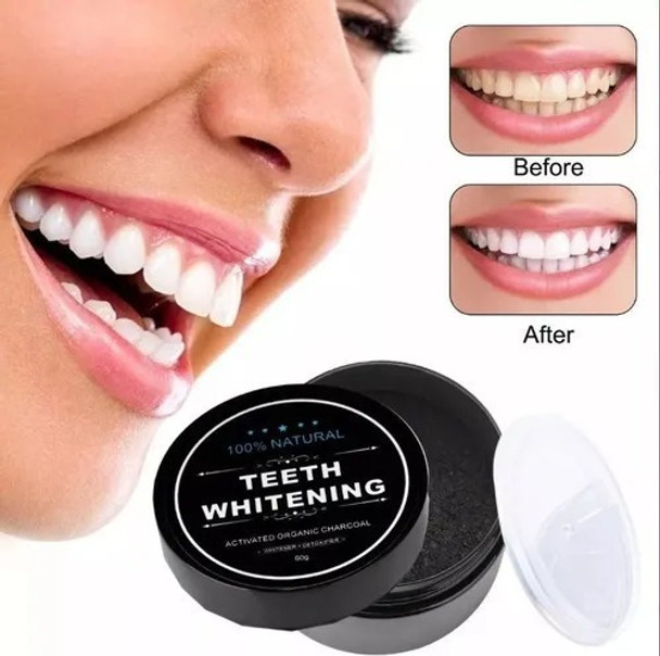 Blanqueador Dental Miracle Teeth Carbon Coco Natural No Dañ 0