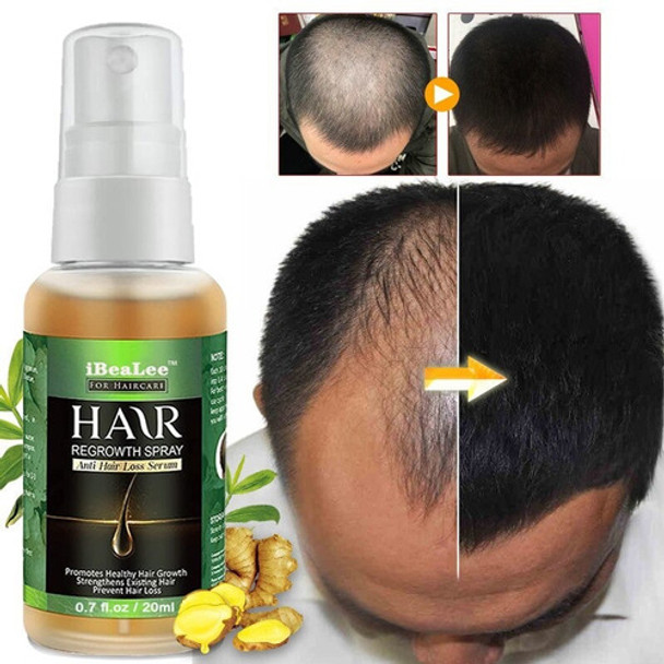 Tratamento De Calvície Cura Cabelo Calvo Freeshipping 0