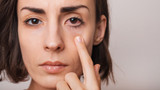 Contact Lenses and Eye Infections: A Comprehensive Guide