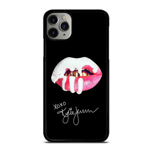KYLIE JENNER LIPS iPhone 11 Pro Case