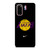 LA LAKERS NBA TEAM LOGO Samsung Galaxy S20 Case