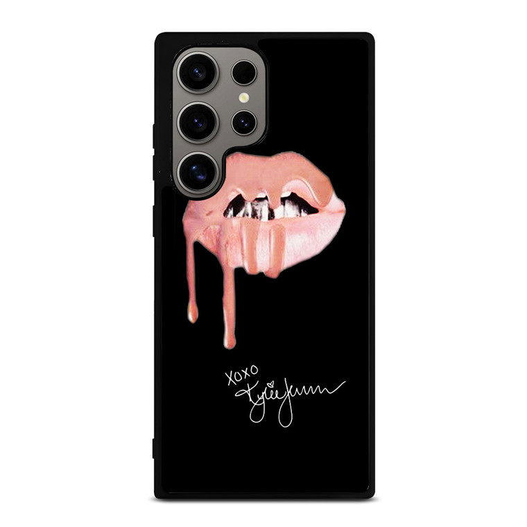 KYLIE JENNER LIPS XOXO Samsung Galaxy S24 Ultra Case