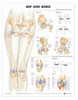 Hip & Knee Poster, Laminated, 20" x 26"