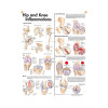Hip & Knee inflammation Poster, Laminated, 20" x 26"