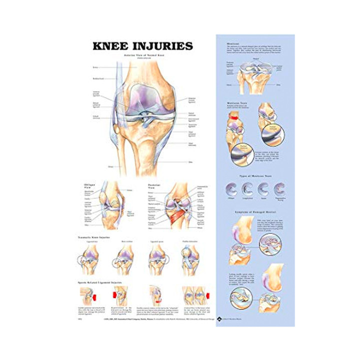 Knee Injuries Poster, Laminated, 20" x 26"