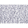 Plaskolite Clear Cracked Ice Acrylic Lens 2'X4' Pack Of 15