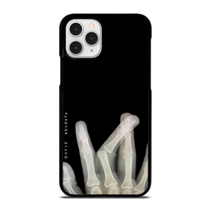 GAYLE ABCDEFU SONG COVER iPhone 11 Pro Case Cover GAYLE ABCDEFU SONG COVER iPhone 11 Pro Case Cover