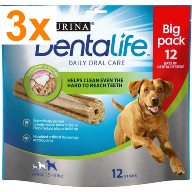 BUNDLE PACK:X3 Purina Dentalife Chew Sticks for Large Dogs