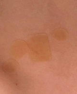 How to Apply Mollenol and Patches: Step-by-Step Guidance