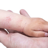 What Are the Stages of Skin Regeneration? Timeline & Signs