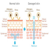 How to Strengthen Skin Barrier: Ingredients, Routine, Diet