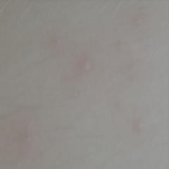 Molluscum Contagiosum vs Folliculitis Molluscum Contagiosum vs Folliculitis