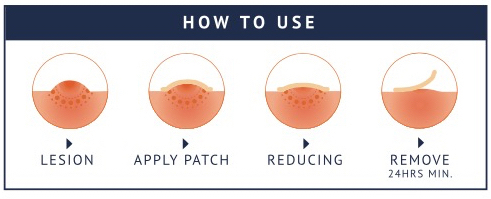 How to use Mollenol Patches