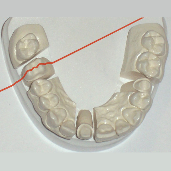 GRAY OPTIC SCANNING STONE 25LB