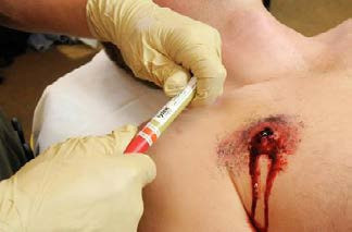 Is the TPAK (Tension Pneumothorax, Airway, and Needle Decompression) part of your Medical Kit?