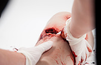 Simbodies Thigh Wound Packing Trainer