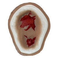 SiMoulage™ SFX 5" Silicone Large Generic Tissue Wound  (Blood Line Compatible)