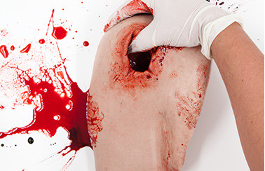 Simbodies Shoulder Wound Packing Trainer