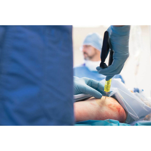 SAM IO Driver Intraosseous Access System