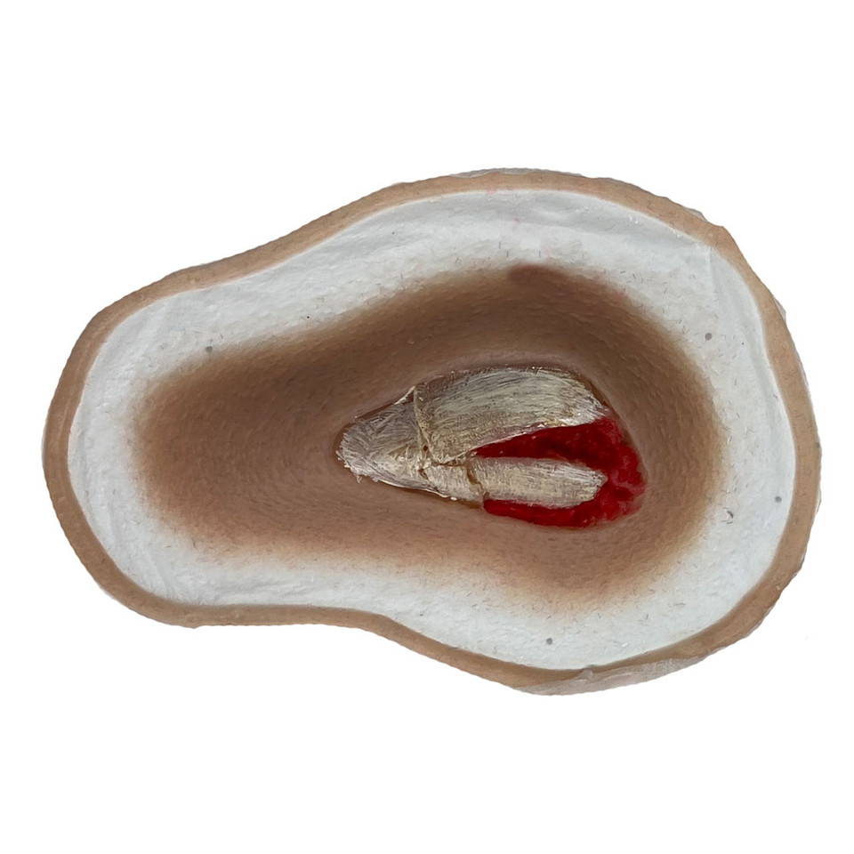 SiMoulage™ SFX 3" Silicone Open Fracture  With Bone Fragments