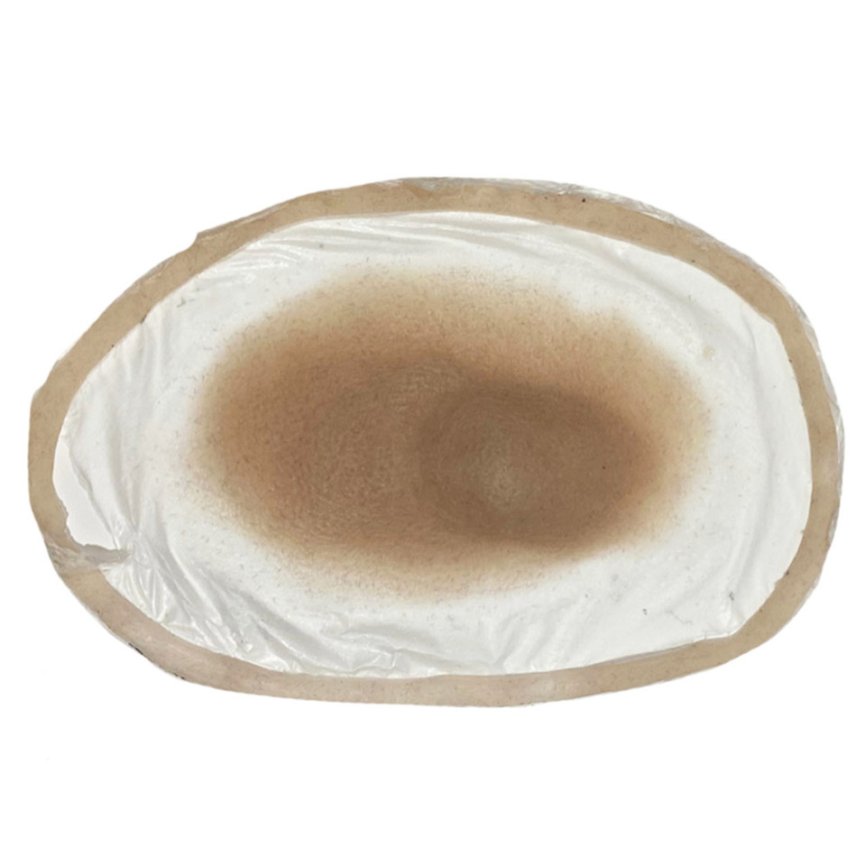 SiMoulage™ SFX Silicone Closed Fracture