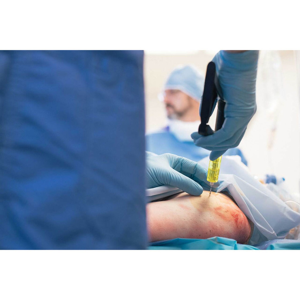 SAM IO Driver Intraosseous Access System