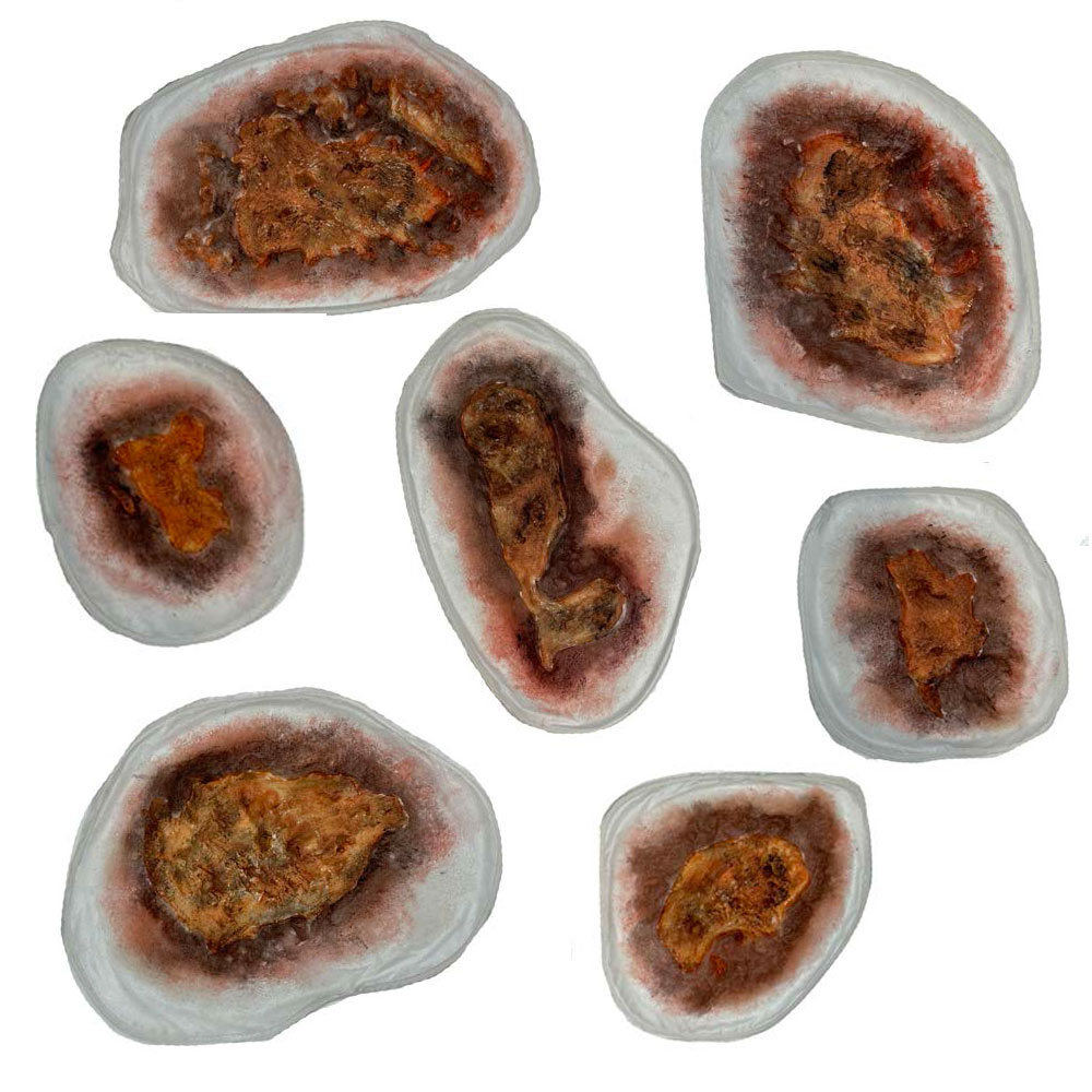 SiMoulage™ SFX Silicone Thermal Burns Set of 7