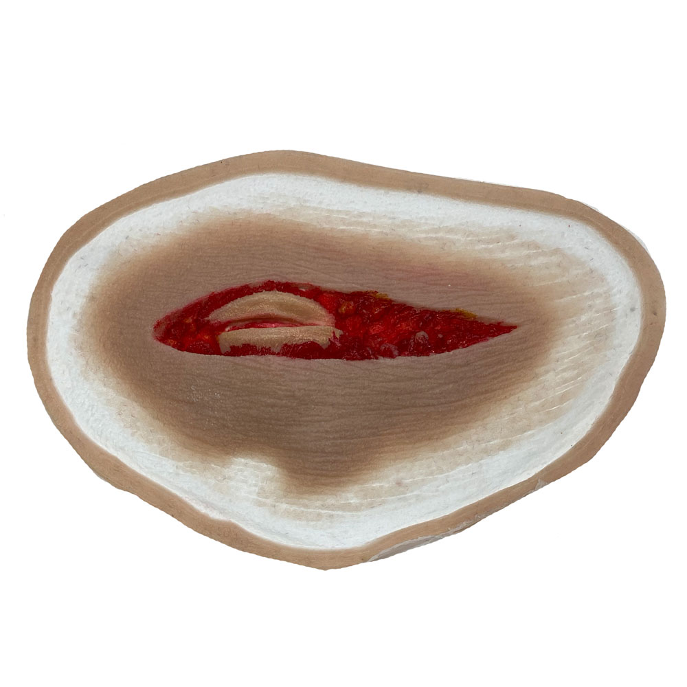 SiMoulage™ SFX Silicone Open Throat Wound With Visible Larynx