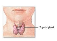 HAIR LOSS, INCREASE IN WEIGHT AND EASY FATIGABILITY CAUSED BY THYROID
