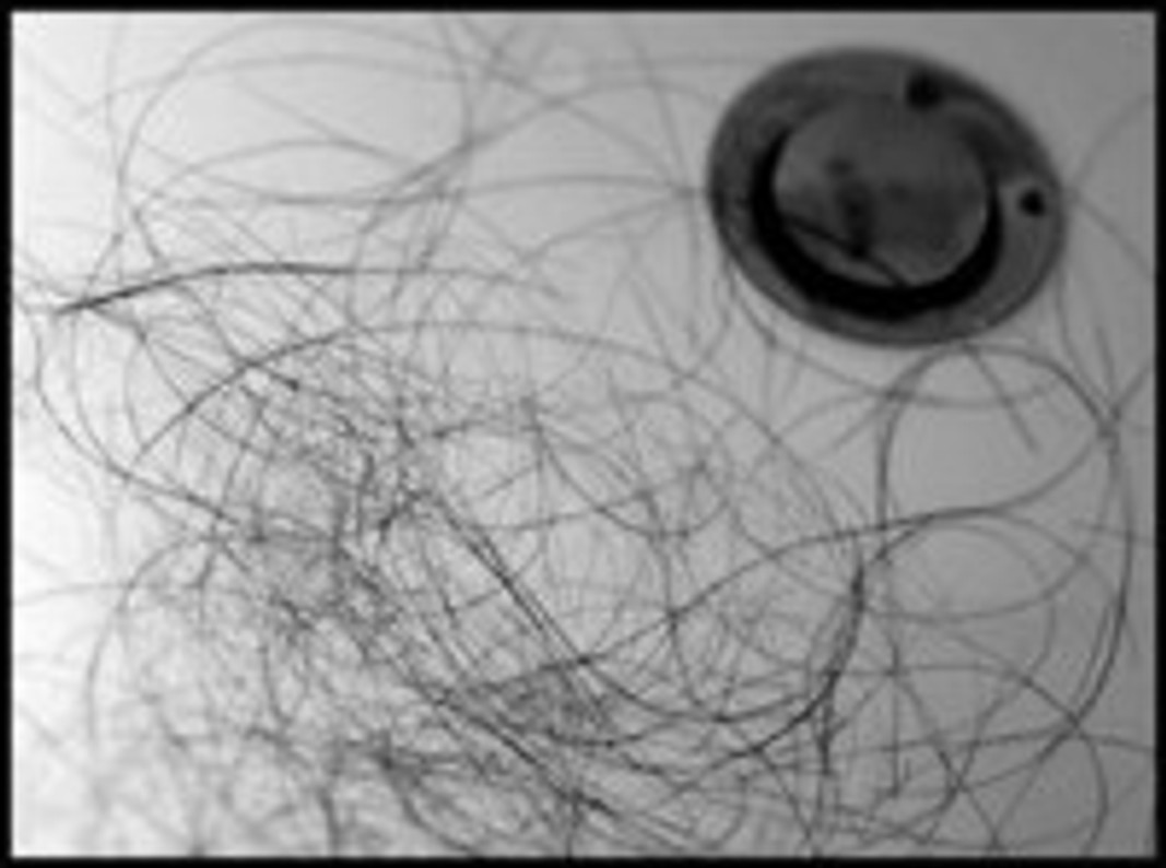 POSSIBLE CAUSES OF HAIR FALLING OUT